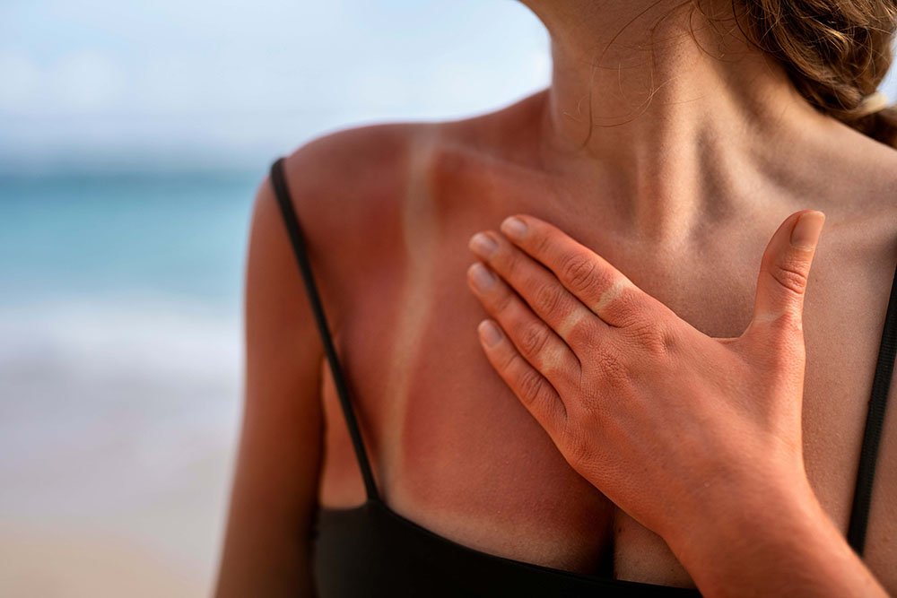 Soothe and Support Burn Healing with Cica GlocalCare (Holistic Approach to Recovery)