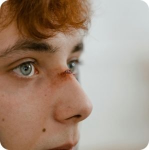injury scar